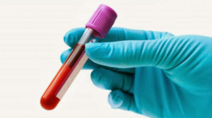 Requisitos para prueba de Embarazo de sangre